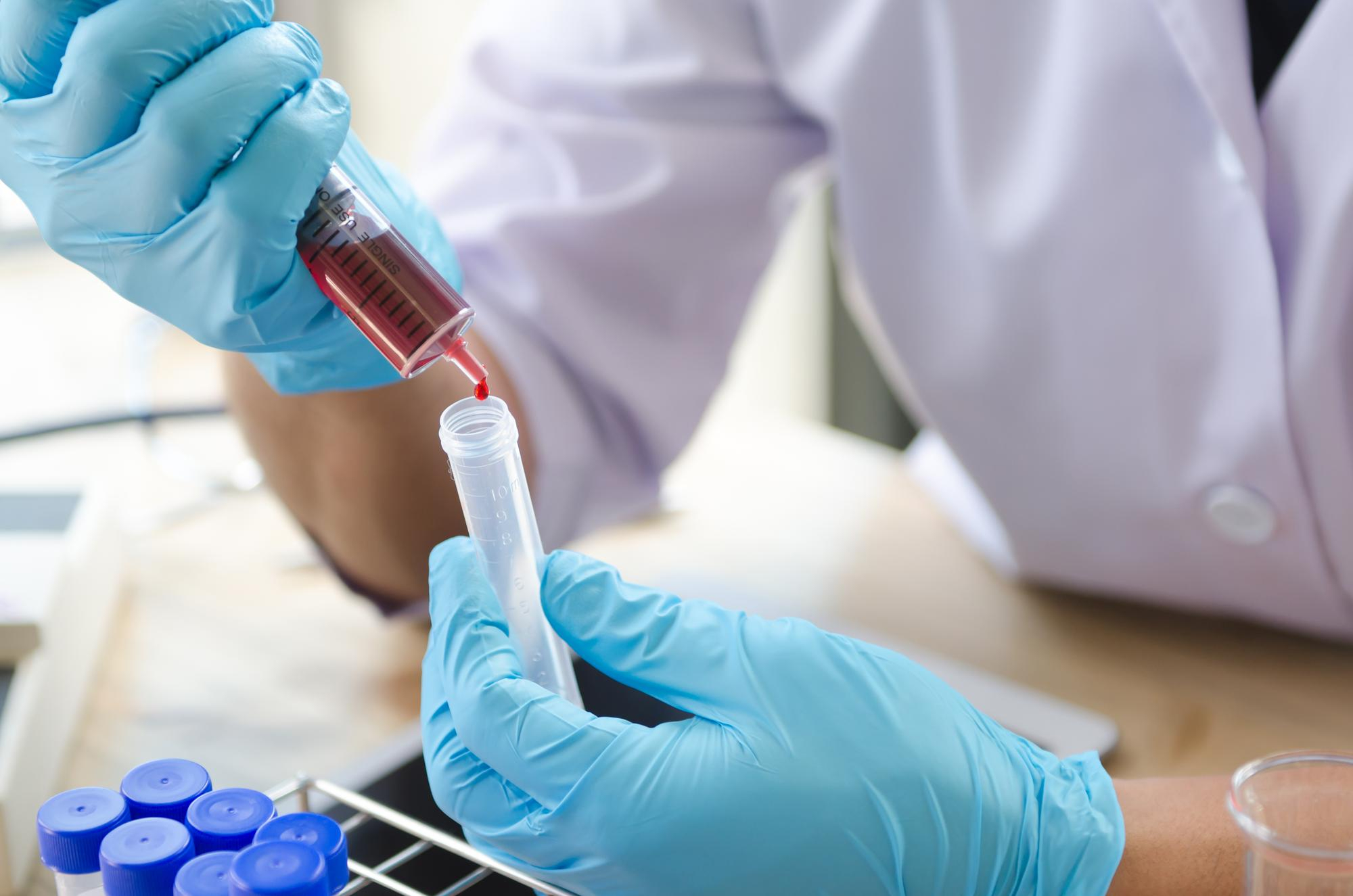 TEST DE COOMBS INDIRECTO